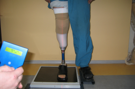 Lazerio procedūra protezą turinčiam klientui